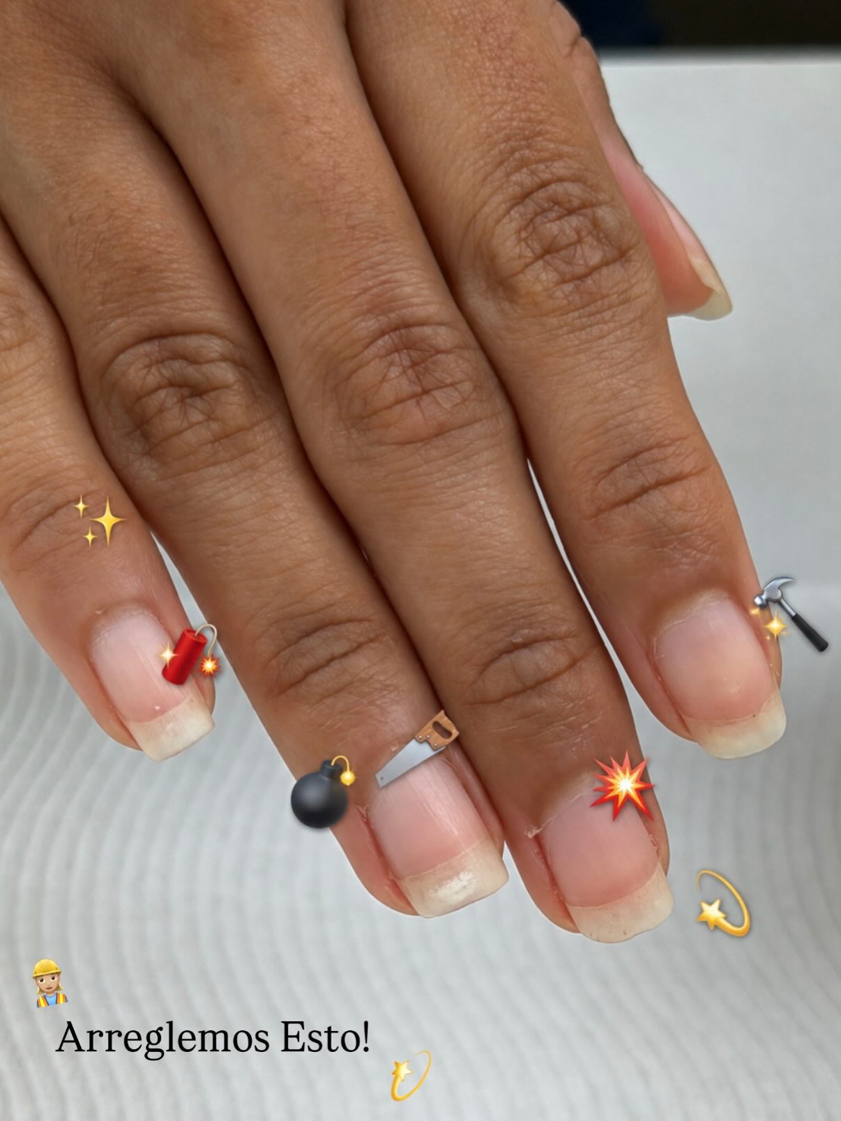 Nail repair transformation